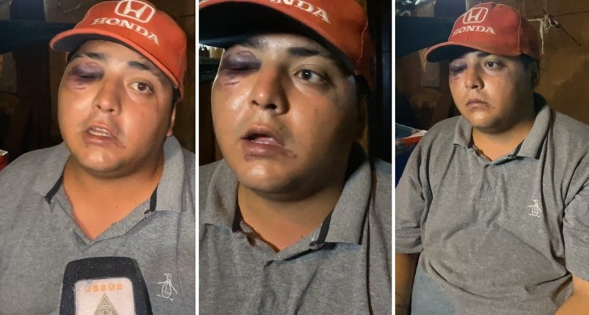Vendedor ambulante agredido en Plaza Independencia: "Me pegaron con un casco en la cabeza"