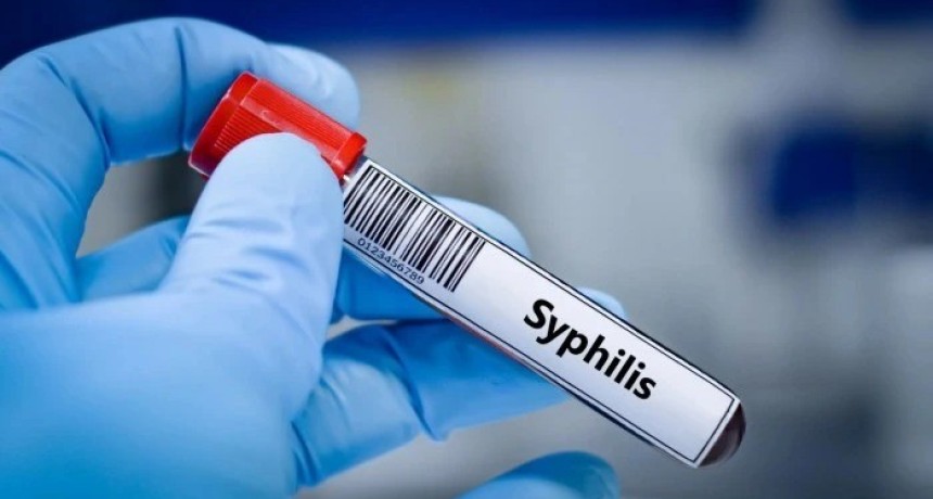 Alerta en Tucumán por aumento de sífilis: el ministro de Salud advierte que los jóvenes 