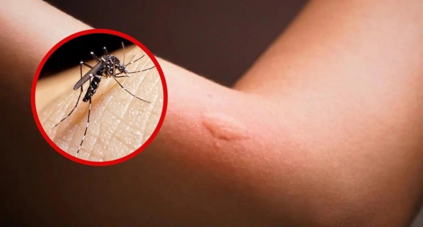 Los mejores trucos caseros para eliminar a los mosquitos para siempre