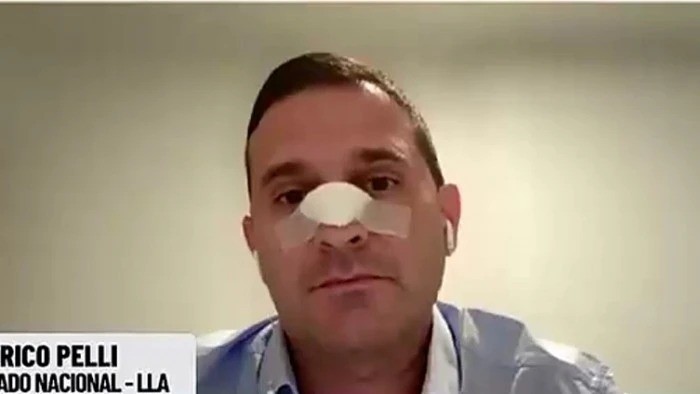 Federico Pelli relat&oacute; la brutal agresi&oacute;n en La Madrid: "Recib&iacute; un cabezazo y perd&iacute; la noci&oacute;n de lo que ocurr&iacute;a"