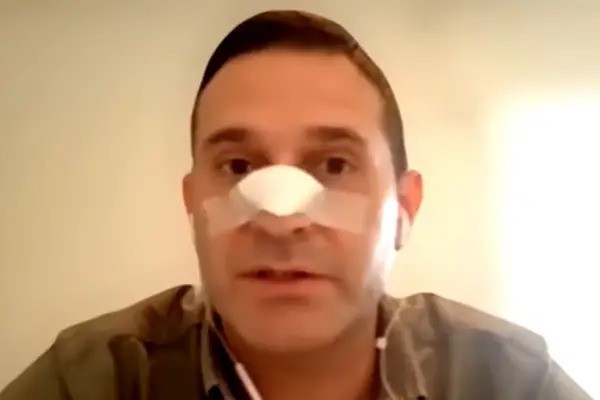 Violencia pol&iacute;tica: Pelli acusa a Monteros de justificar la agresi&oacute;n y pide investigar a la Polic&iacute;a