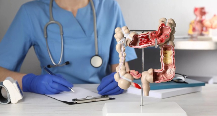 C&aacute;ncer de Colon: la importancia de la prevenci&oacute;n y los avances en terapias dirigidas en Argentina