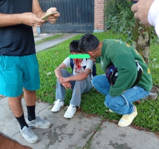 Un adolescente se golpe&oacute; el rostro al caer en bicicleta por un bache en Yerba Buena