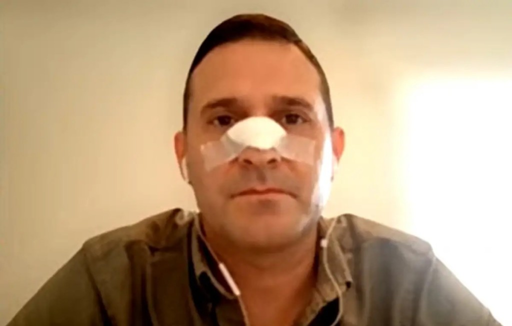 Caso Pelli: la querella denunci&oacute; irregularidades en la investigaci&oacute;n por la agresi&oacute;n al diputado