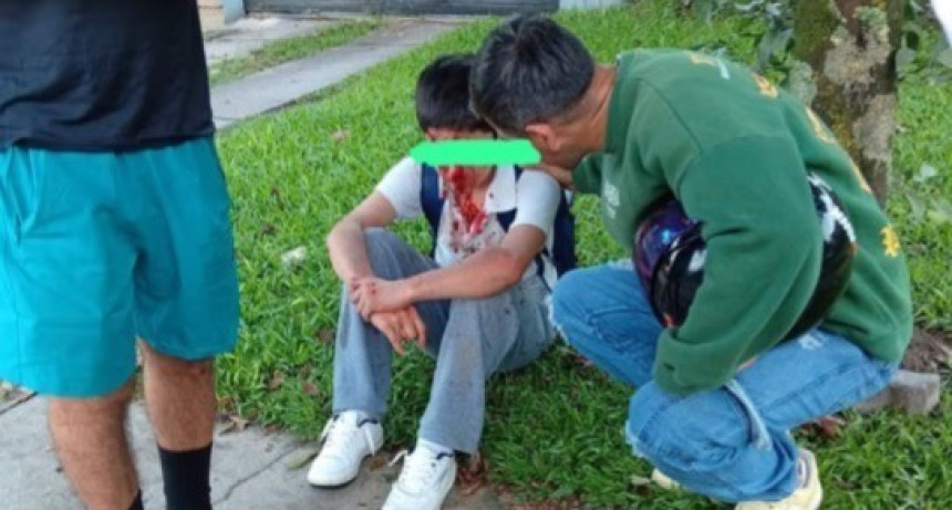 Un adolescente se golpe&oacute; el rostro al caer en bicicleta por un bache en Yerba Buena