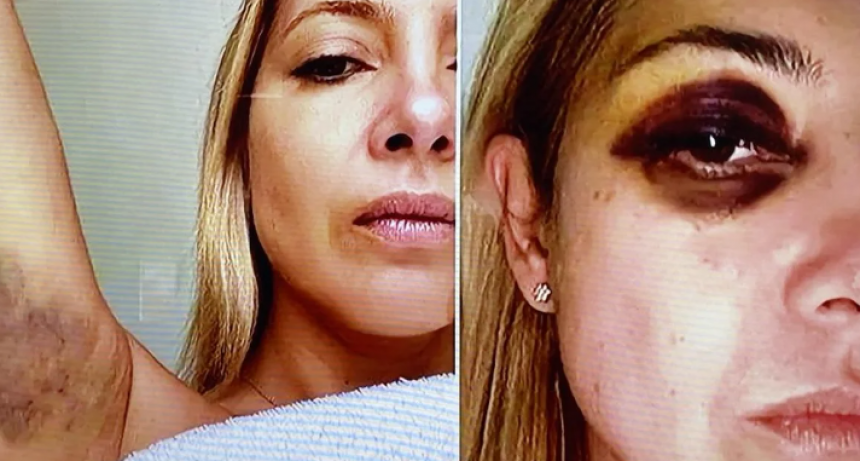 Difundieron fotos de Fabiola Yáñez golpeada y chats reveladores