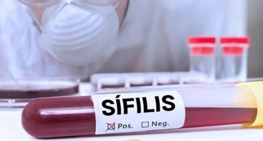 La sífilis alcanza récords históricos en Argentina con más de 36.000 casos anuales